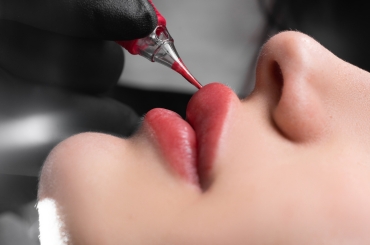 Lip Pigmentation Treatment in Chennai
