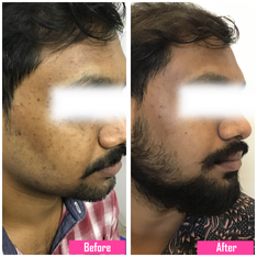 pigmentation image