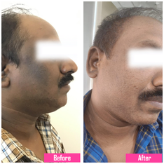 pigmentation image