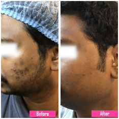 pigmentation image