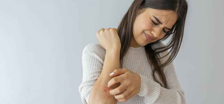 Lichen Planus Treatment Chennai